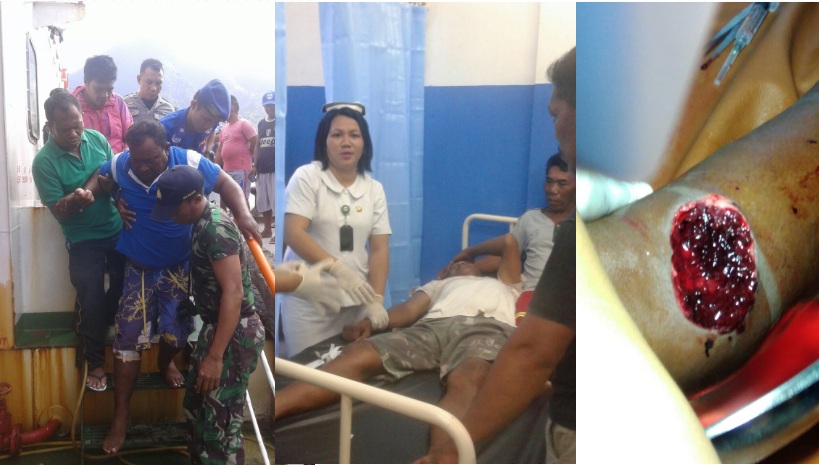 Betis Nyaris Bocor, Makhluk Laut Macam Apa yang Serang ABK KM Baku Sayang?