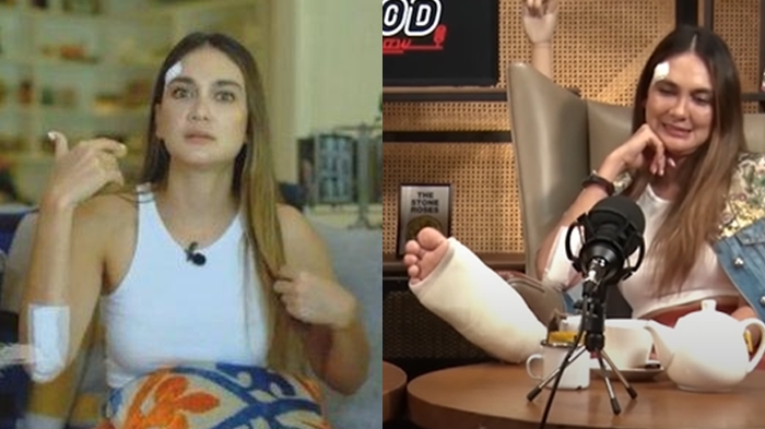Luna Maya Pede Keluar Rumah dengan Badan Penuh Luka: 'Daripada Sakit Hati, Mending Gue Kayak Begini'