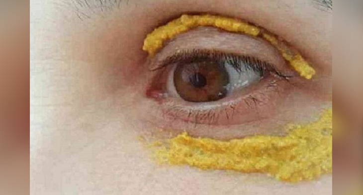 Inginkan Wajah Cantik dan Bercahaya? Tak Perlu Operasi Kulit, Cukup dengan Kunyit