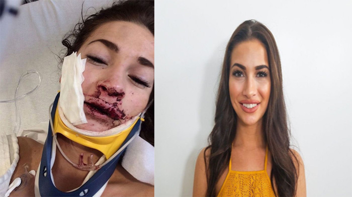 Sempat Keluhkan Hal Ini di Malam Natal, Artis Film Olivia Nova Mati Muda