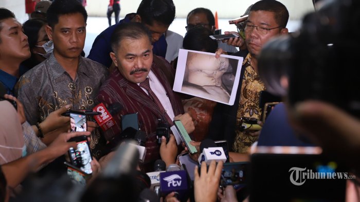 Sosok Kamaruddin Simanjuntak, Dulu Seorang Sales, Pernah Tangani Kasus Wisma Atlet hingga e-KTP