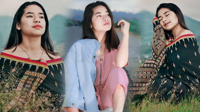 Penampilan Chetryn Peto Kakak Kandung Betrand Disorot Netizen, Lihat Warna Rambutnya