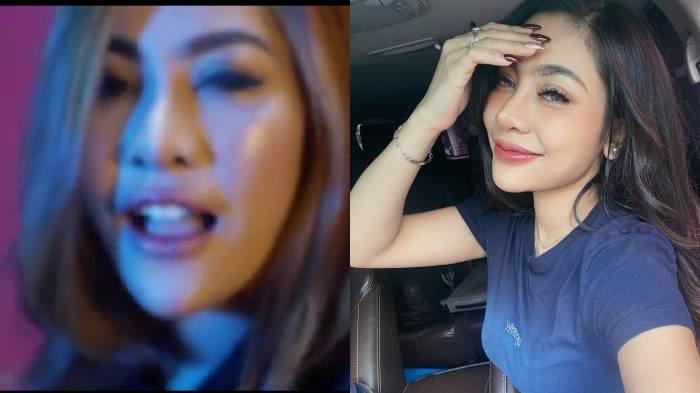 Sederet Artis yang Ramai Diberitakan Oplas di Tahun 2021, Ada yang Dagunya Semakin Runcing