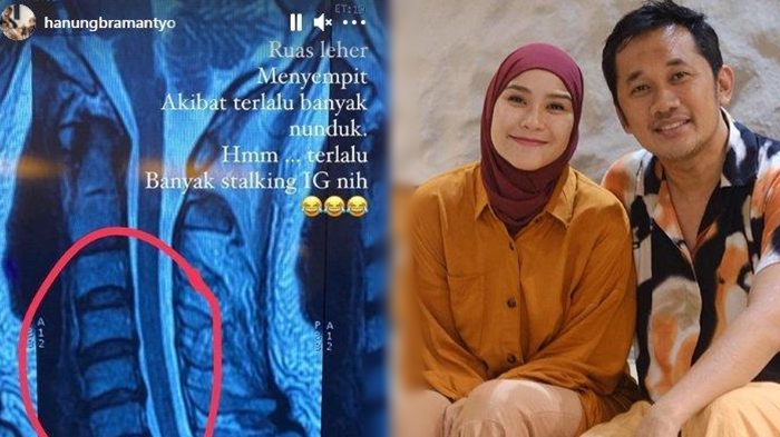 suami-zaskia-adya-mecca-hanung-bramantyo-alami-penyempitan-di-leher.jpg