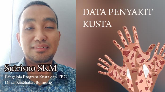 sutrisno-skm-pengelola-program-kusta-dan-tbc-dinas-kesehatan-bolmong.jpg