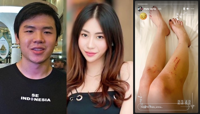 Masih Ingat Ayu Thalia? Dulu Polisikan Nicholas Sean Anak Ahok, Kini Malah Dia yang Jadi Tersangka