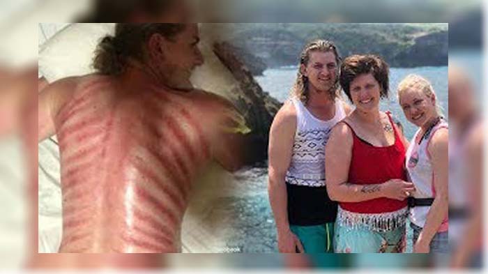 Kaget Lihat Punggungnya usai Dikerik Lalu Heran Sakitnya Sembuh, Turis di Bali Panggil Tukang Pijat