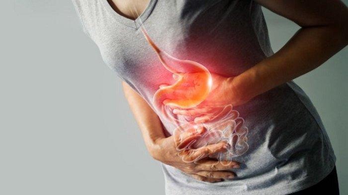 usus-buntu-inilah-gejala-dan-ciri-ciri-usus-buntu-yang-harus-diwaspadai-foto-ilustrasi.jpg