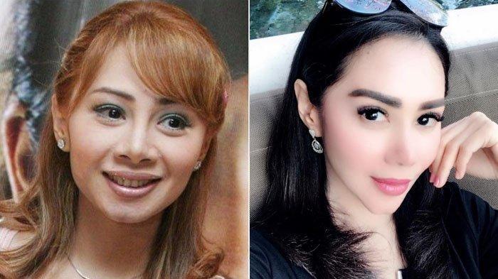 wajah-femmy-permatasari-dulu-dibanding-sekarang1.jpg