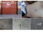 7-fakta-anak-dibully-gegara-pr-berujung-tancapan-pensil-di-dada.jpg