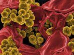 Apa-itu-Superbug-pandemi-yang-saat-ini-tengah-melanda-India.jpg
