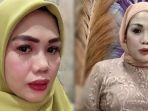 Elly-Sugigi-makin-cantik-setelah-potong-gigi.jpg