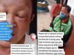 Kasihan-SekaliDriver-Ojol-Ini-Babak-Belur-Dikeroyok-3-Orang-Tak-Dikenal-Dituduh-Serobot-Antrian.jpg