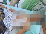 Kondisi Terkini Sertu Brili Damopolii, Anggota TNI yang Jadi Korban Penikaman di Pangi Bolmong Sulut