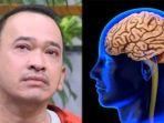 Ruben-Onsu-mengidap-penyakit-langka-yang-disebut-Empty-Sella-Syndrome.jpg