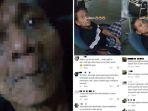 Viral-Video-Anak-Laki-laki-Buang-Ayah-yang-Stroke-Anak-Perempuan-Tega-Sekali-Berbuat-ini-ke-Ayah.jpg