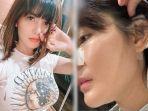 angela-lee-lakukan-operasi-hidung-kedua-kalinya-akibat-implan-yang-nyaris-keluar-menembus-kulit.jpg
