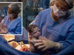 bayi-perempuan-baru-lahir-pasang-wajah-marah-saat-dokter-berkali-kali-mencoba-buatnya-menangis.jpg