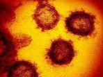 bentuk-virus-corona-di-mikroskop-343.jpg