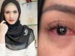 donita-alami-gejala-mirip-covid-19.jpg