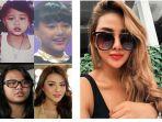 dulu-item-dan-tembem-kini-aurel-hermansyah-terlihat-makin-cantik-bernarkah-operasi-plastik.jpg