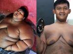 dulu-jadi-bocah-paling-gemuk-di-dunia-seberat-192-kilogram-kondisi-arya-permana-kini-bikin-kaget.jpg