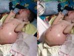foto-bayi-denis-yang-diupload-akun-susanti-di-medsos-mengundang-simpati-warga.jpg