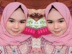 gadis-bernama-diana-ningsih-dibakar-aparat-polisi-brigadir-an-yang-ketahuan-sudah-memiliki-istri.jpg