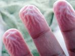 jari-keriput_20171008_144854.jpg