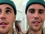 justin-bieber-alami-lumpuh-batal-tour-ke-indonesia.jpg