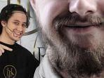 kevin-aprilio-tanamkan-rambut-dari-bagian-tubuh-lain-di-dagu-apa-itu-transplantasi-jenggot.jpg