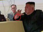 luka-misterius-tangan-kim-jong-un.jpg