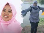 masih-ingat-kekeyi-usai-filler-hidung-hingga-berubah-drastis-kini-mau-ubah-bentuk-tubuh-ini.jpg