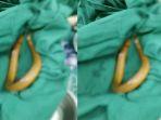 masukan-belut-ke-dalam-perut.jpg