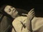 misteri-pandemi-1916-penyakit-tidur-yang-bikin-banyak-orang-meninggal-dalam-lelap-begini-gejalanya.jpg