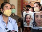 nindy-ayunda-beberkan-bukti-kdrt-hingga-perselingkuhan-askara-parasady-harsono.jpg
