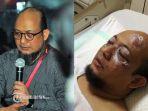 novel-baswedan-jelaskan-pengobatan-tentang-matanya-yang-tersiram-air-keras.jpg