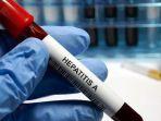 penyakit-hepatitis-a-ternyata-bisa-menyebar-dengan-cepat-ini-cara-pencegahannya.jpg