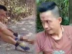 pria-yang-viral-yang-tetap-tenang-meski-tangannya-terputus.jpg