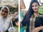 sarah-sesa-ms-21-wanita-asal-cianjur-disiram-air-keras-oleh-suaminya-sendiri.jpg