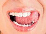 tindik-lidah_20180806_131113.jpg