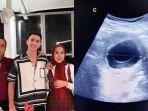 verrell-bramasta-bertemu-ferry-irawan-venna-melinda-ungkap-hasil-usg-perutnya.jpg