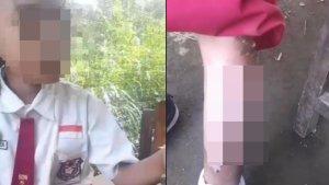 ANAK-di-jember-disiksa-tante-sendiri.jpg