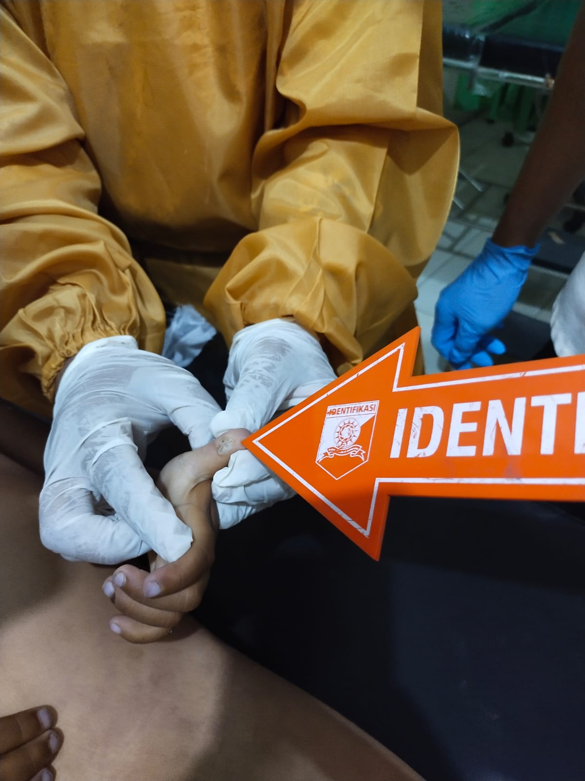 Tunggu Teman Ganti Baju, Balita di  Ponorogo Pegang Bola Lampu Tersengat Listrik