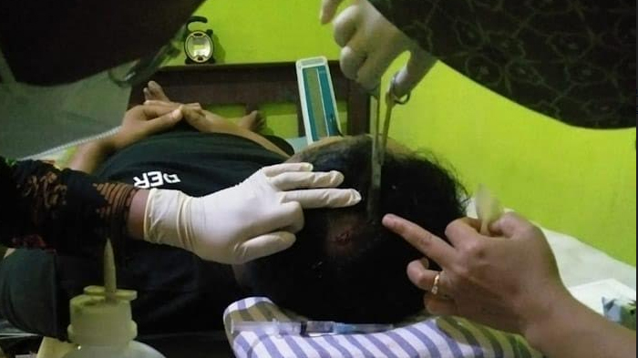 Atap Sekolah di Pacitan Ambrol Sebabkan Guru Luka Parah, Permintaan Renovasi Tak Pernah Digubris