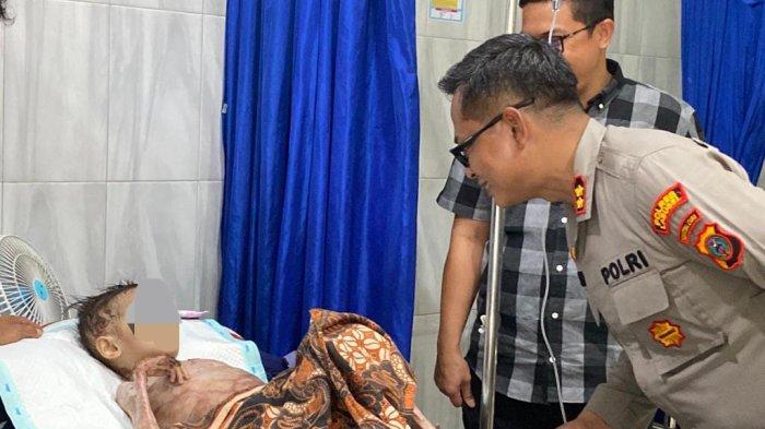 Begini Perhatian Kapolres Labusel Terhadap Balita yang Sakit Selama 3 Tahun