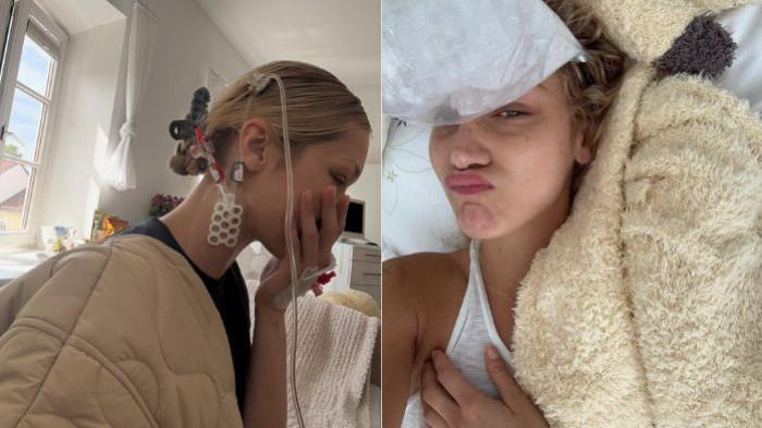 Bella Hadid sakit lyme disease