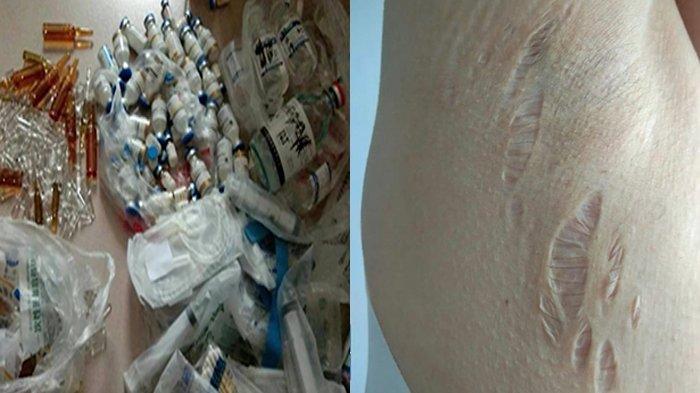 DIDUGA Selingkuh, Seorang Dokter Nekat Racuni Mantan Istri Sampai Cacat, Kulit Jadi Retak-retak