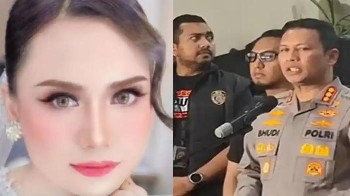 DUDUK Perkara Model Ansy Jan De Vries Ngaku Kena Begal Hingga Koma, Ternyata Bohong, Untuk Apa?