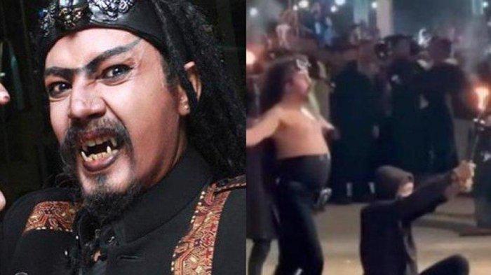 Detik-detik Jenggot Limbab Terbakar Saat Sembur Api, Penonton Histeris, Pesulap Dilarikan ke RS